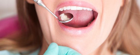 Guide to Paying for Dental Care: Credit Cards and Beyond